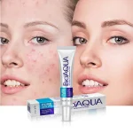 Bioaqua Anti Acne Cream Price in Pakistan