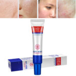 BIOAQUA Acne Elimination Tender Clean Face Acne Cream