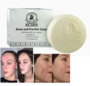 Dr. James Acne Organic Soap