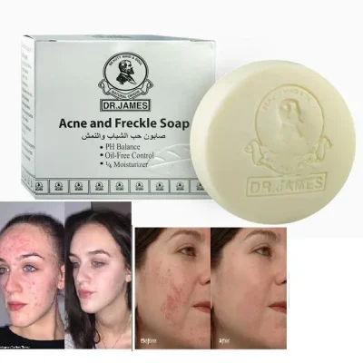 Dr. James Acne Organic Soap
