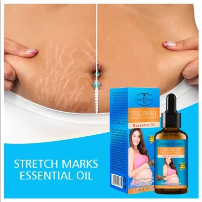 Aichun Beauty Stretch Marks Oil - 3 Days Effective