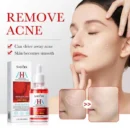 SADOER AHA+BHA Acne Repair Serum