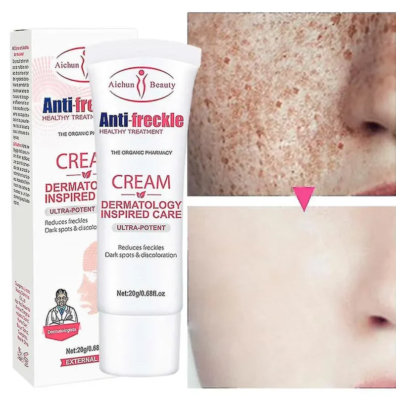 Aichun Beauty Anti Freckle Cream
