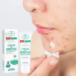 Aichun Beauty Acne Remove Face Cream
