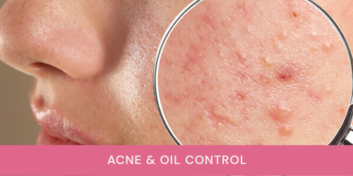 Acne & Oil Control