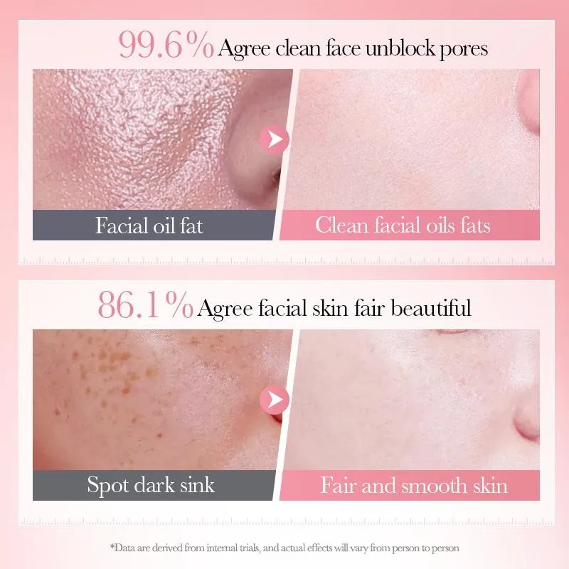 SADOER 4 IN 1 Whitening & Moisturizing Facial Cleanser - Image 2